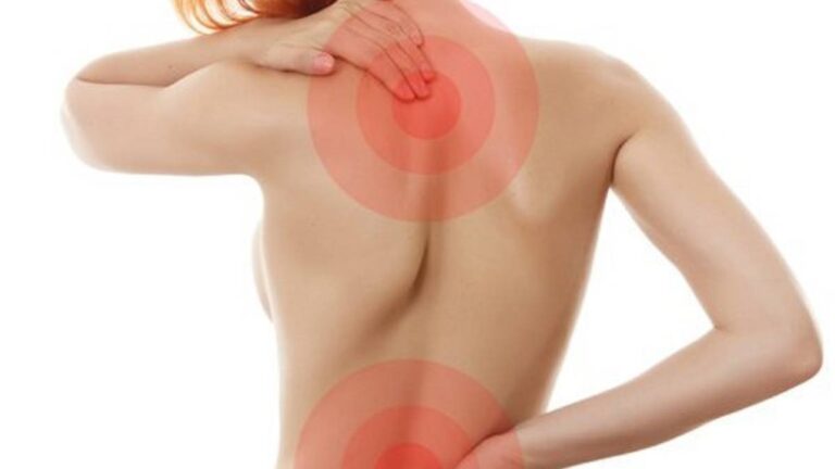 Mujer con puntos de dolor en espalda.