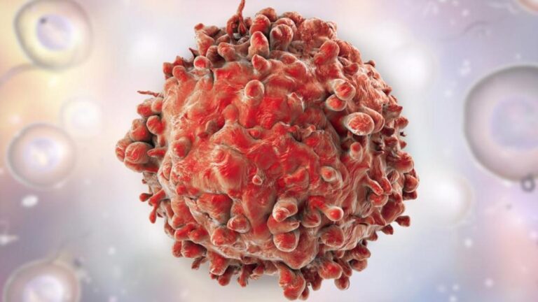 cáncer