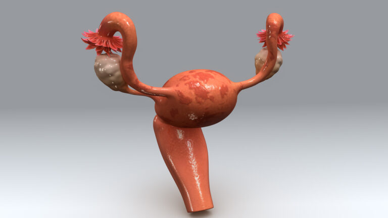 útero en 3D