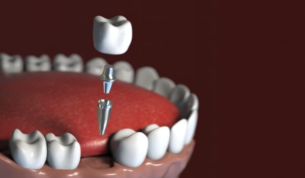 Crean fármaco para hacer crecer nuevos dientes