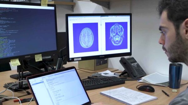 Crean modelo tumoral impreso en 3D contra el cáncer