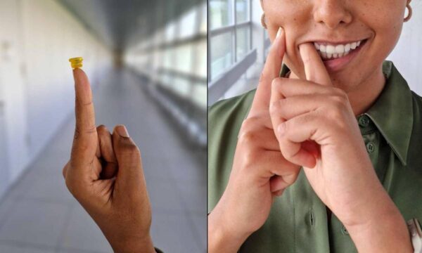 Crean parches inspirados en tentáculos del pulpo