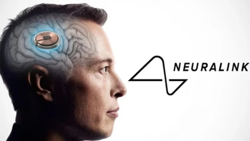 Musk busca voluntarios para implantar su chip cerebral