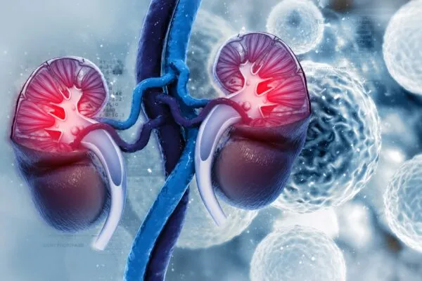 Cáncer renal altera células grasas cercanas y modifica el microambiente que rodea al tumor renal.