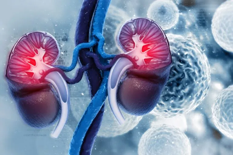 Cáncer renal altera células grasas cercanas y modifica el microambiente que rodea al tumor renal.