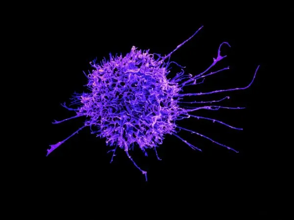 Paclitaxel provoca una respuesta mecánica inesperada en células tumorales durante una investigación sobre resistencia