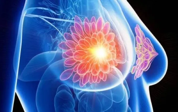 Medicina de precisión aplicada al cáncer de mama mediante análisis de biomarcadores y tecnologías médicas para tratamientos personalizados.